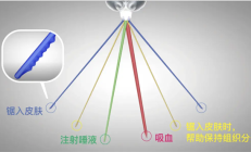 一巴掌拍死蚊子 它的嘴会断在你的肉里吗